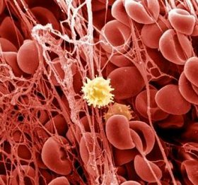 Biorezonance